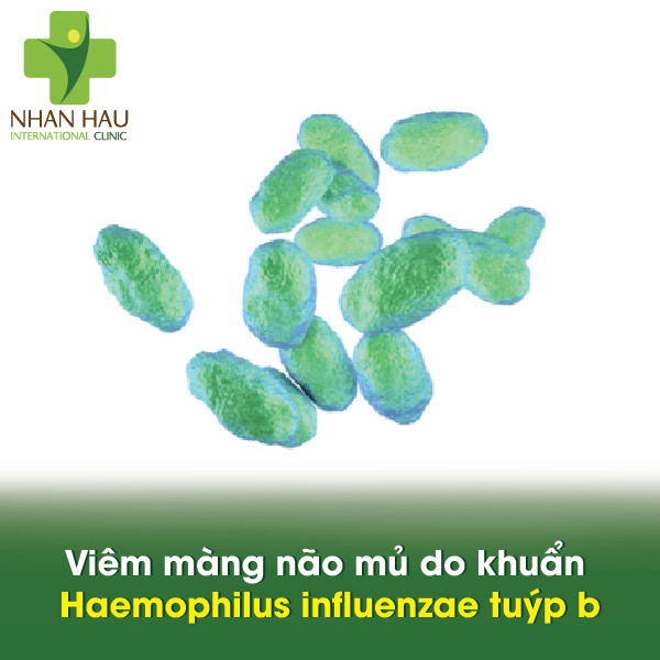 Viêm màng não mủ do khuẩn Haemophilus influenzae tuýp b
