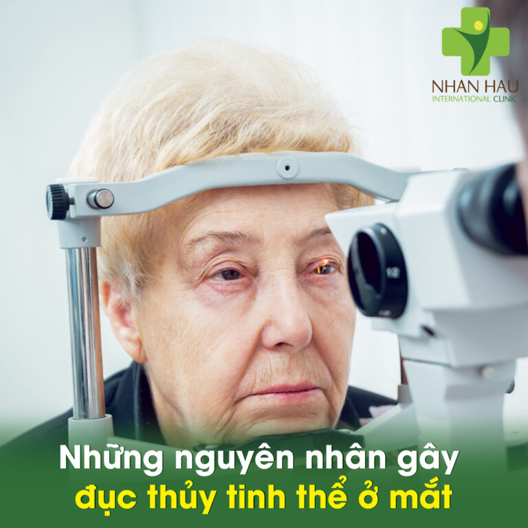 Những nguyên nhân gây đục thủy tinh thể ở mắt