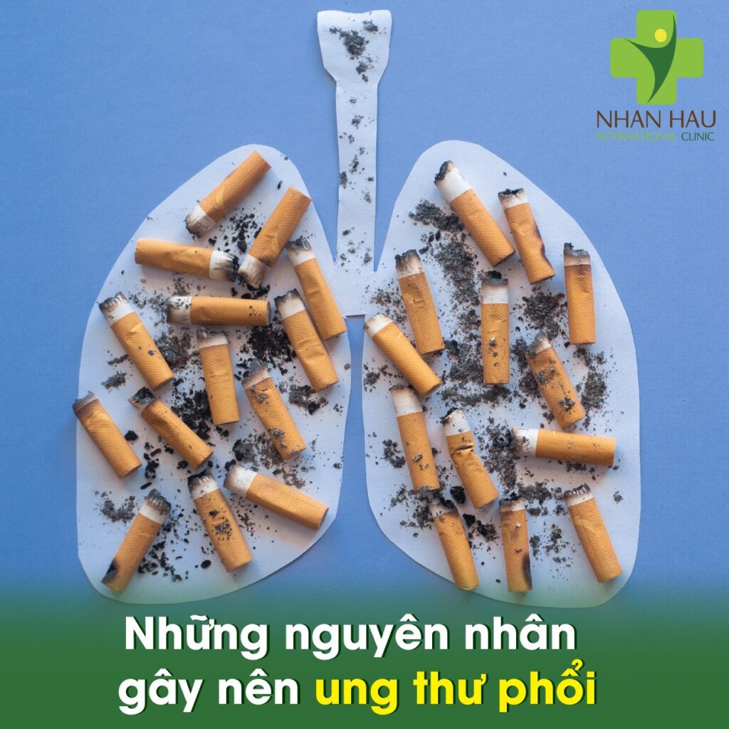 Những nguyên nhân gây nên ung thư phổi