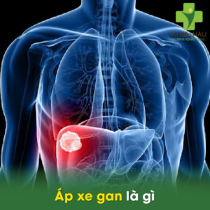 Áp xe gan là gì