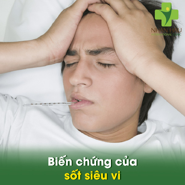 Câu hỏi thường gặp về sốt virus