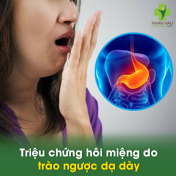 Triệu chứng hôi miệng do trào ngược dạ dày