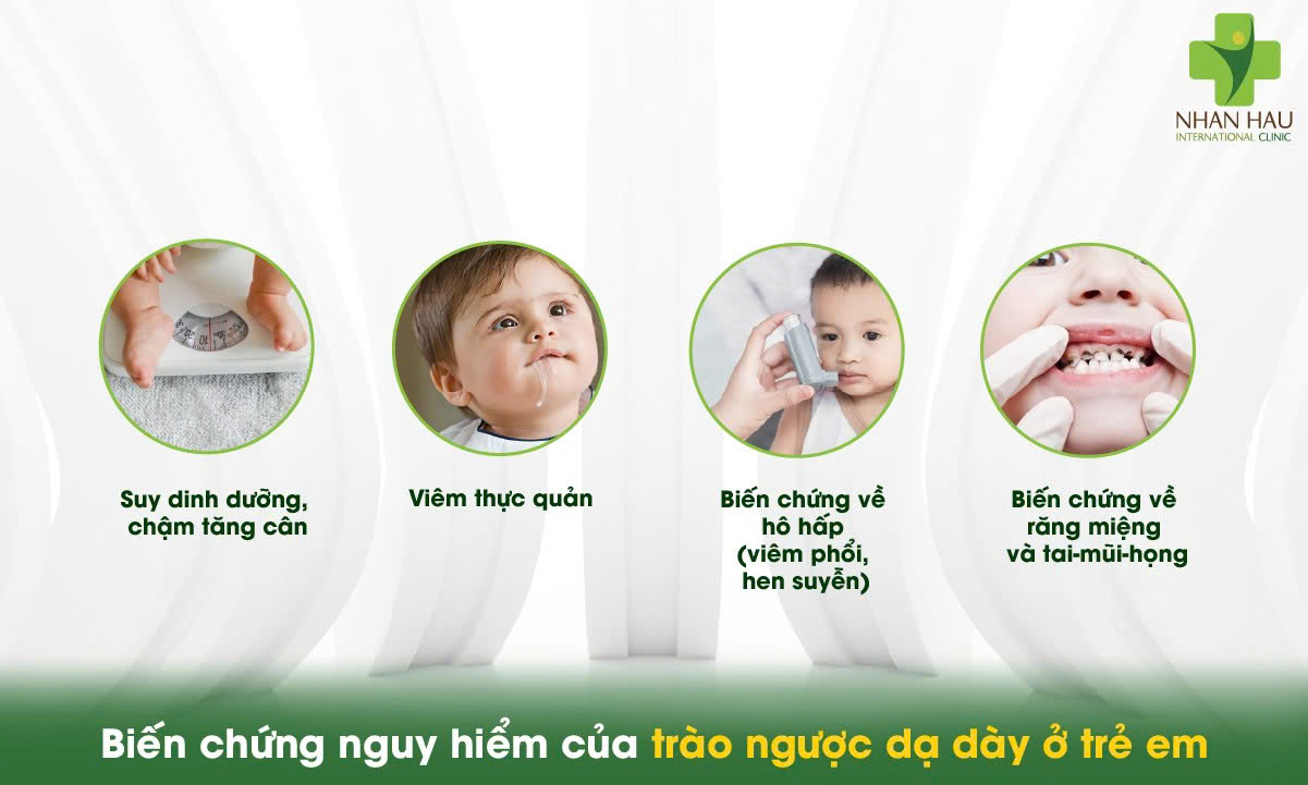 Trào ngược dạ dày ở trẻ em: Nguyên nhân, triệu chứng và cách điều trị nhanh tại nhà 4 Biến chứng nguy hiểm của trào ngược dạ dày ở trẻ em