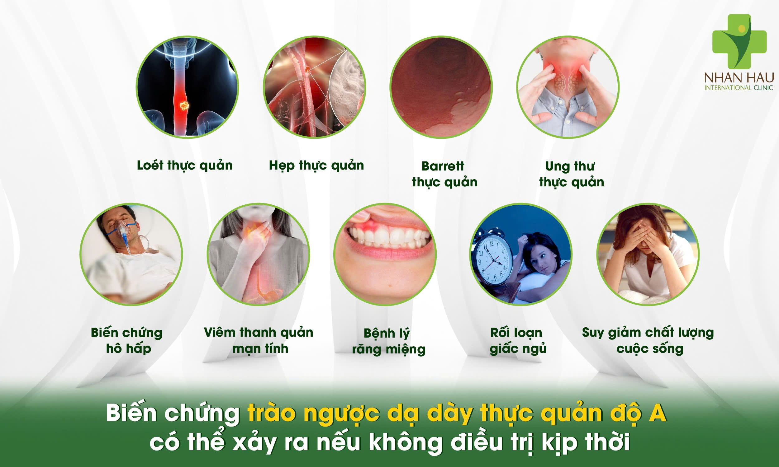 Trào ngược dạ dày thực quản độ A: Nguyên nhân, triệu chứng và cách điều trị 6 Biến chứng trào ngược dạ dày thực quản độ A có thể xảy ra nếu không điều trị kịp thời