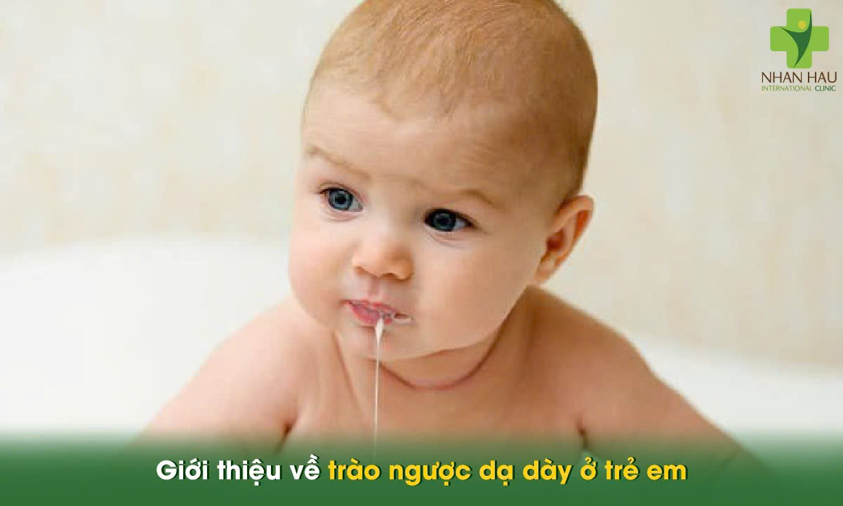 Trào ngược dạ dày ở trẻ em: Nguyên nhân, triệu chứng và cách điều trị nhanh tại nhà 1 Giới thiệu về trào ngược dạ dày ở trẻ em