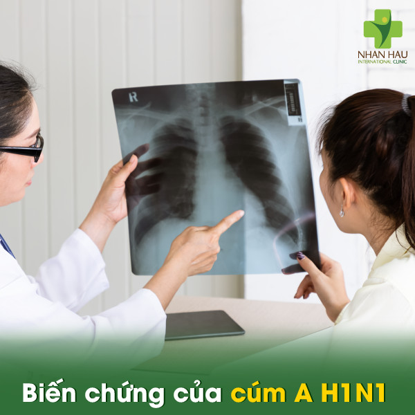 Biến chứng của cúm A H1N1