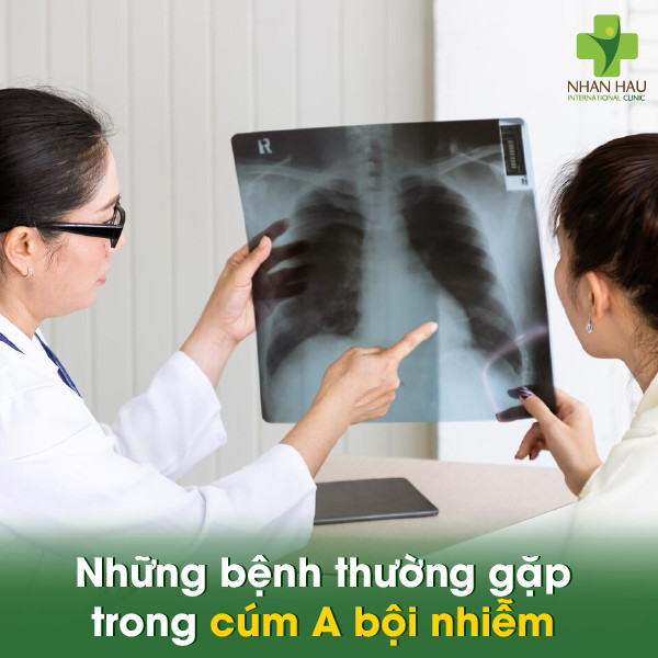 Cúm A bội nhiễm - Nguy hiểm tiềm ẩn và cách phòng ngừa hiệu quả 3 Những bệnh thường gặp trong cúm A bội nhiễm