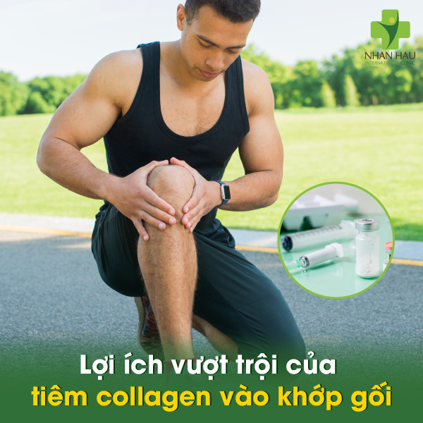 Tiêm collagen vào khớp gối: Giải pháp trẻ hóa và bảo vệ khớp gối hiệu quả 2 Lợi ích vượt trội của tiêm collagen vào khớp gối