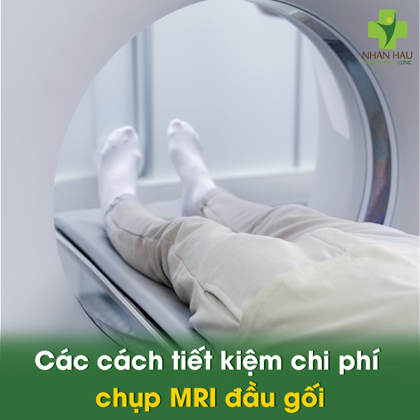 Các cách tiết kiệm chi phí chụp MRI đầu gối
