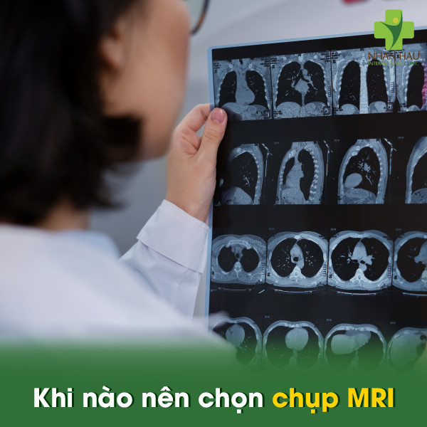 Phân biệt ưu nhược điểm chụp MRI và chụp CT 4 Khi nào nên chọn chụp MRI