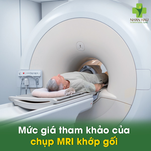 Mức giá tham khảo của chụp MRI khớp gối