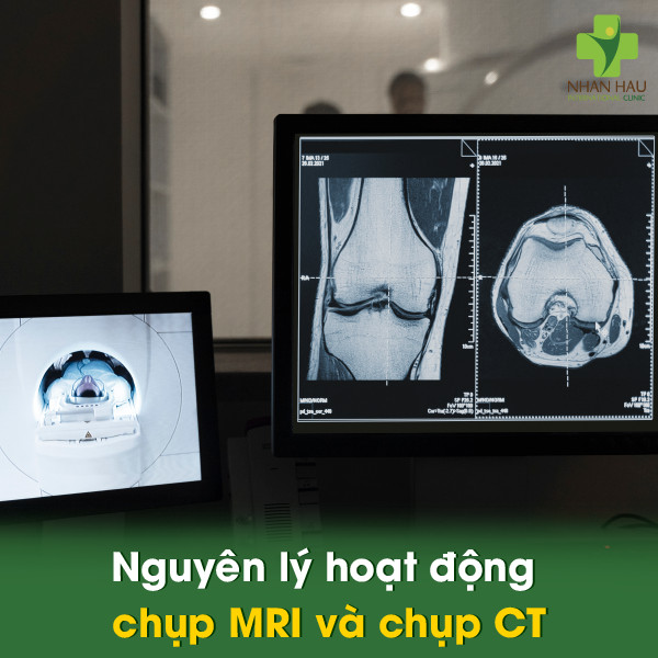 Nguyên lý hoạt động chụp MRI và chụp CT