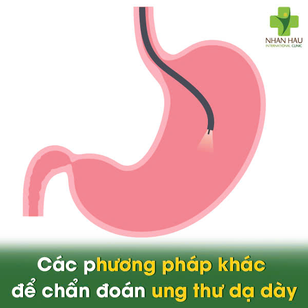 Các phương pháp khác để chẩn đoán ung thư dạ dày