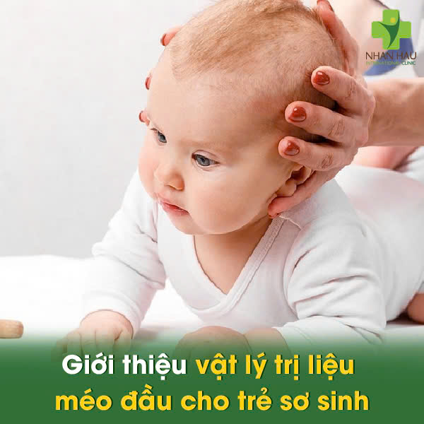 Giới thiệu vật lý trị liệu méo đầu cho trẻ sơ sinh