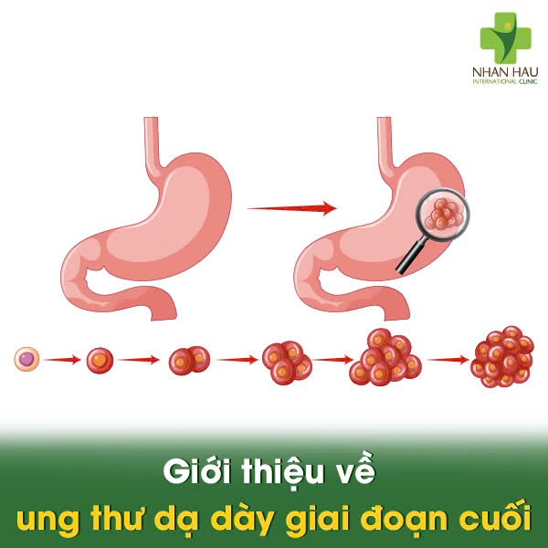 Giới thiệu về ung thư dạ dày giai đoạn cuối