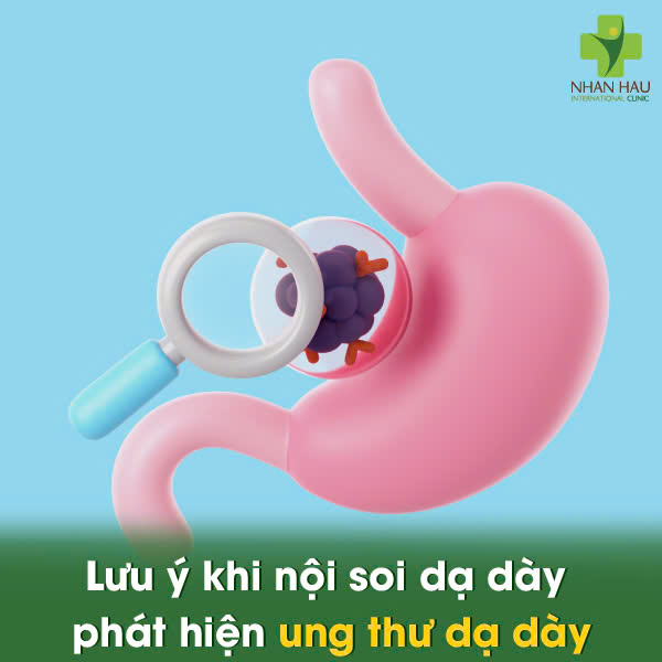 Lợi ích của việc nội soi dạ dày tầm soát ung thư