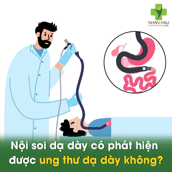 Nội soi dạ dày có phát hiện được ung thư dạ dày không