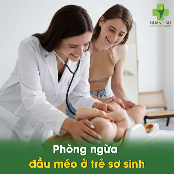 Phòng ngừa đầu méo ở trẻ sơ sinh