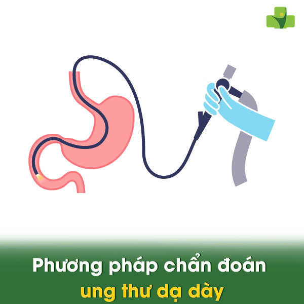 Phương pháp chẩn đoán ung thư dạ dày