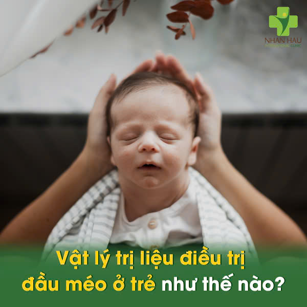 Vật lý trị liệu điều trị đầu méo ở trẻ như thế nào?