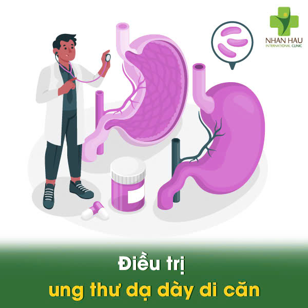 Điều trị ung thư dạ dày di căn