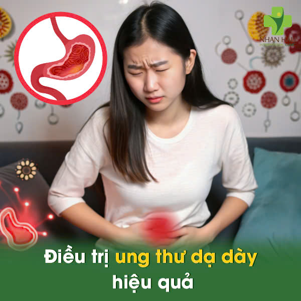 Cây Thuốc Nam Chữa Ung Thư Dạ Dày: Hiểu Đúng Về Công Dụng và Rủi Ro 4 Điều trị ung thư dạ dày hiệu quả