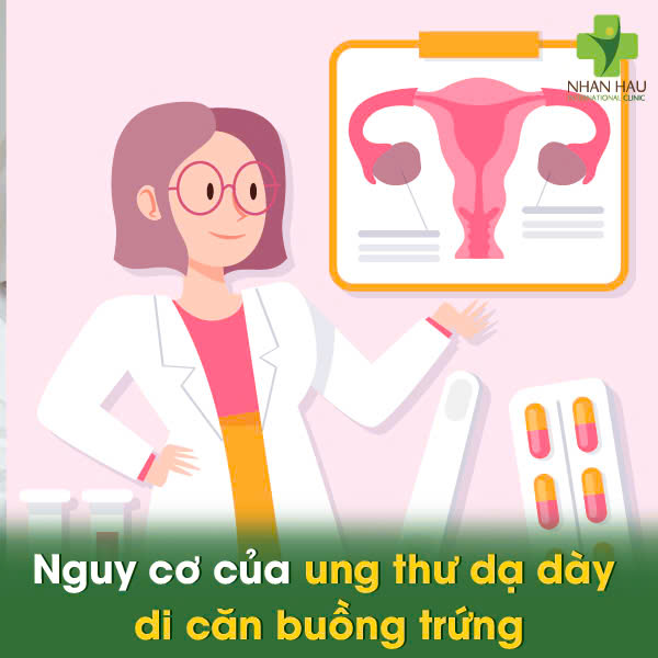 Nguy cơ của ung thư dạ dày di căn buồng trứng