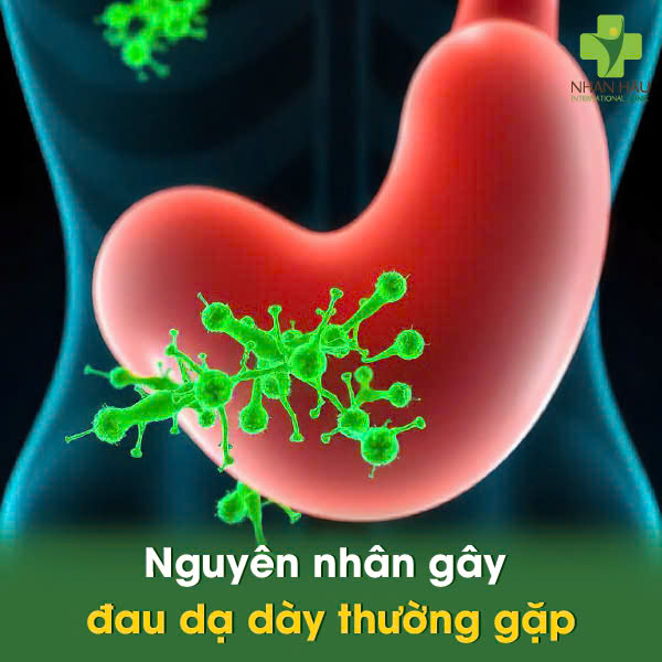 Nguyên nhân gây đau dạ dày thường gặp