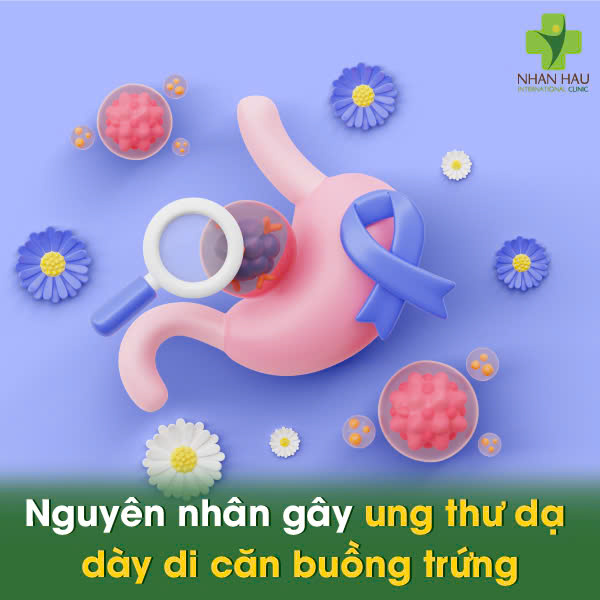 Nguyên nhân gây ung thư dạ dày di căn buồng trứng