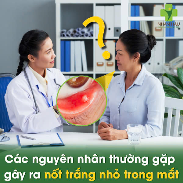 Các nguyên nhân thường gặp gây ra nốt trắng nhỏ trong mắt