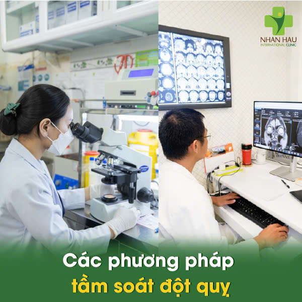 Các phương pháp tầm soát đột quỵ