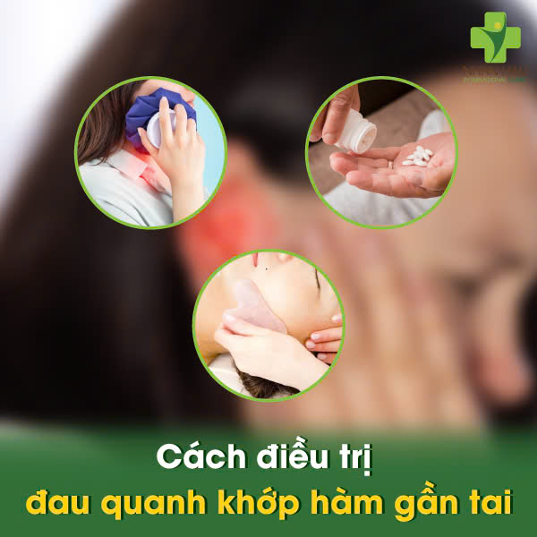 Cách Điều Trị Đau Quanh Khớp Hàm Gần Tai