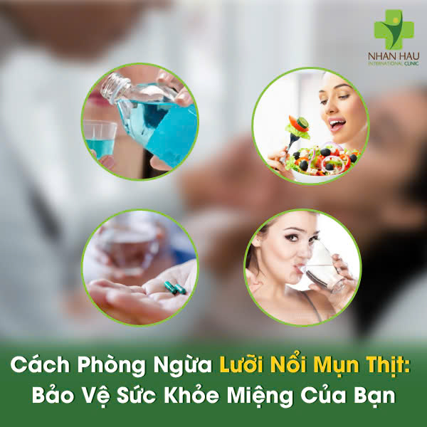 Cách Phòng Ngừa Lưỡi Nổi Mụn Thịt: Bảo Vệ Sức Khỏe Miệng Của Bạn