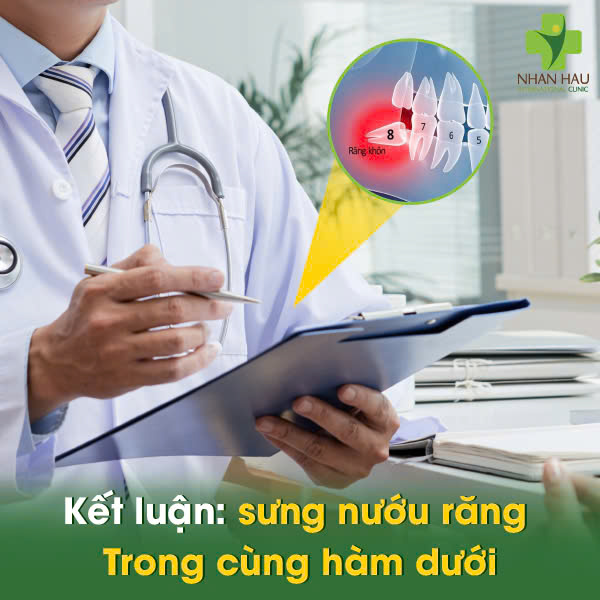 Kết luận: Sưng Nướu Răng Trong Cùng Hàm Dưới