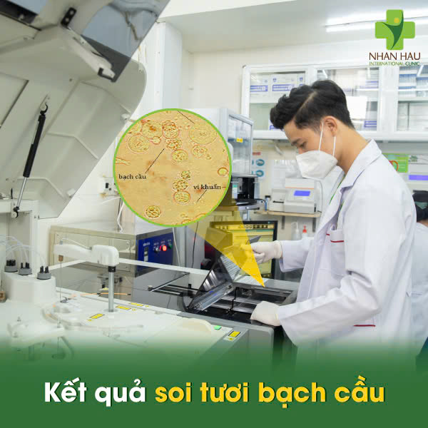 Kết quả soi tươi bạch cầu