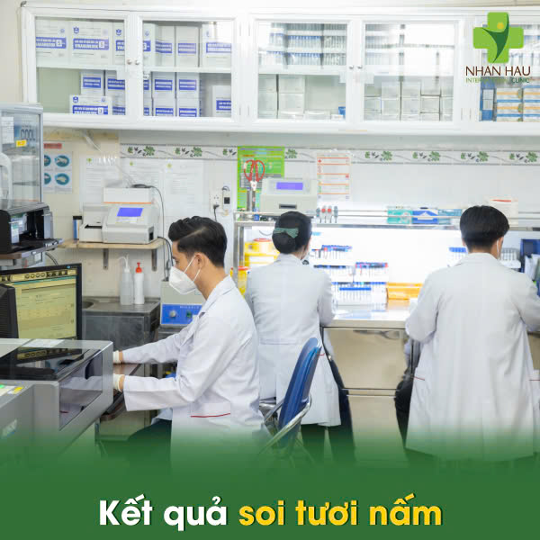 Kết quả soi tươi nấm