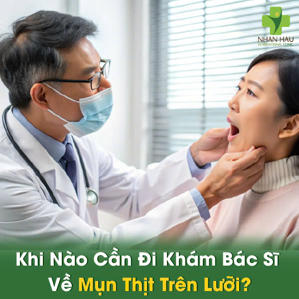 Khi Nào Cần Đi Khám Bác Sĩ Về Mụn Thịt Trên Lưỡi?