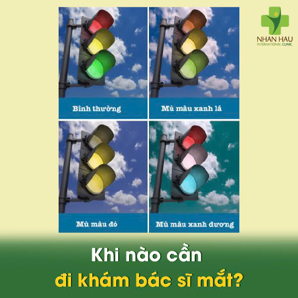 Khi nào cần đi khám bác sĩ mắt?