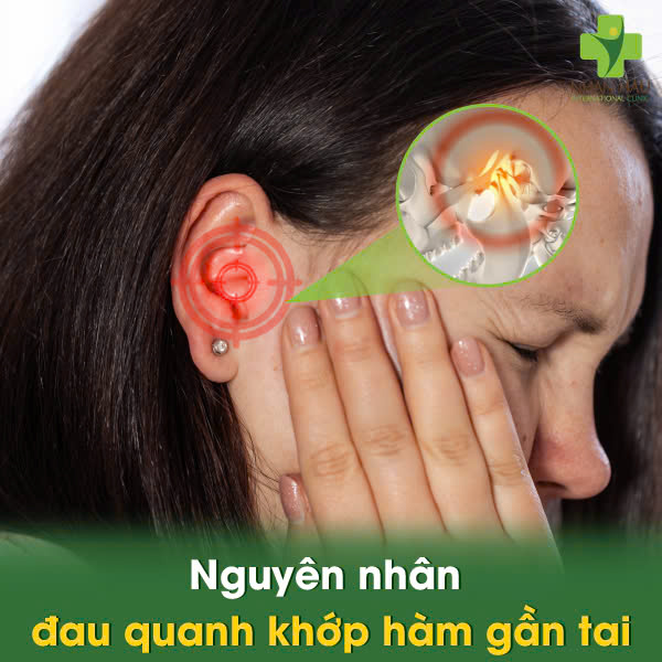 Nguyên Nhân Đau Quanh khớp Hàm Gần Tai