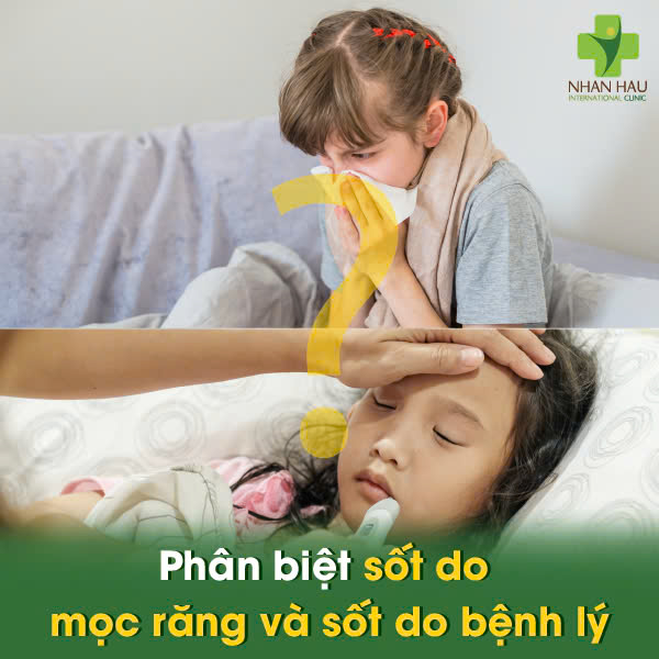 Phân biệt sốt do mọc răng và sốt do bệnh lý