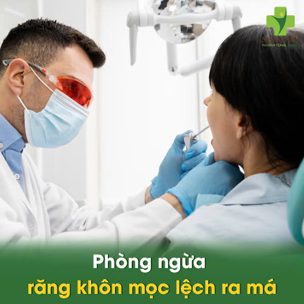 Phòng ngừa răng khôn mọc lệch ra má