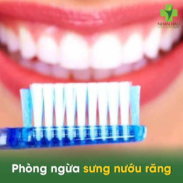 Phòng ngừa sưng nướu răng