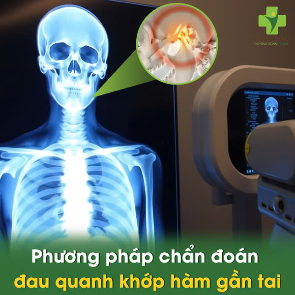 Phương Pháp Chẩn Đoán Đau Quanh Khớp Hàm Gần Tai