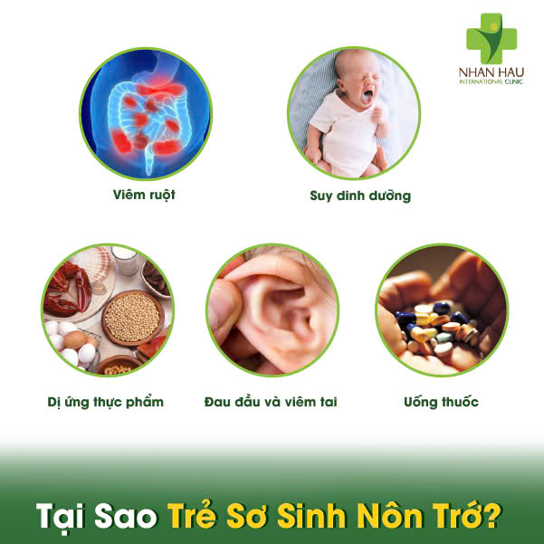 Trẻ Sơ Sinh Nôn Trớ: Phân Biệt Bình Thường & Bất Thường - Hướng Dẫn Xử Trí An Toàn Cho Ba Mẹ! 2 Tại Sao Trẻ Sơ Sinh Nôn Trớ?