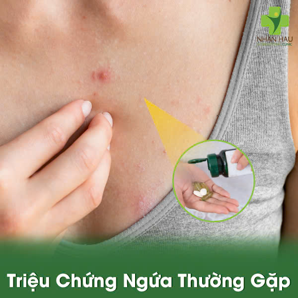 Triệu Chứng Ngứa Thường Gặp