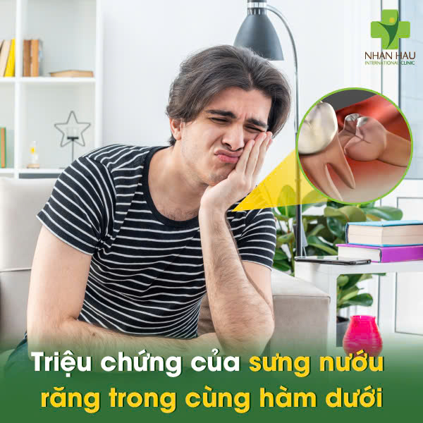 Triệu chứng của sưng nướu răng trong cùng hàm dưới