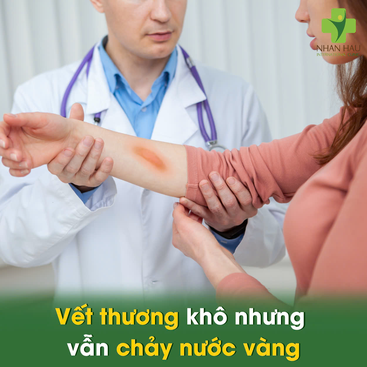 Vết thương khô nhưng vẫn chảy nước vàng