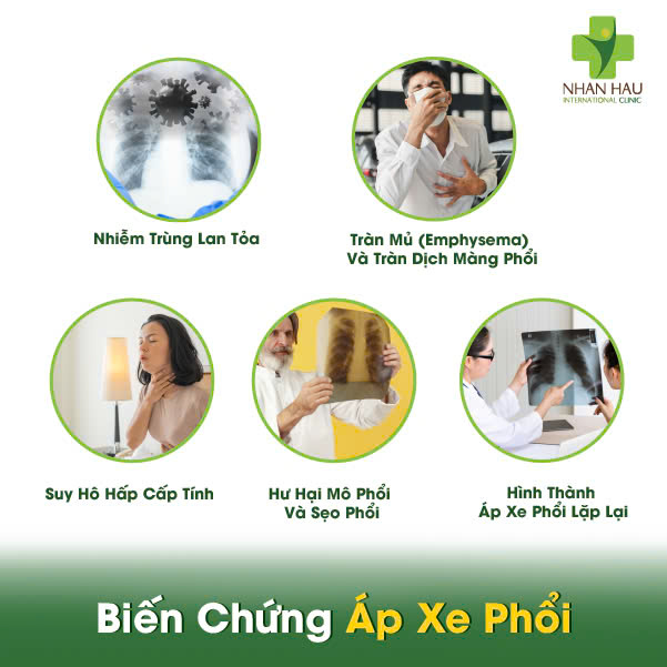 Biến Chứng Áp Xe Phổi