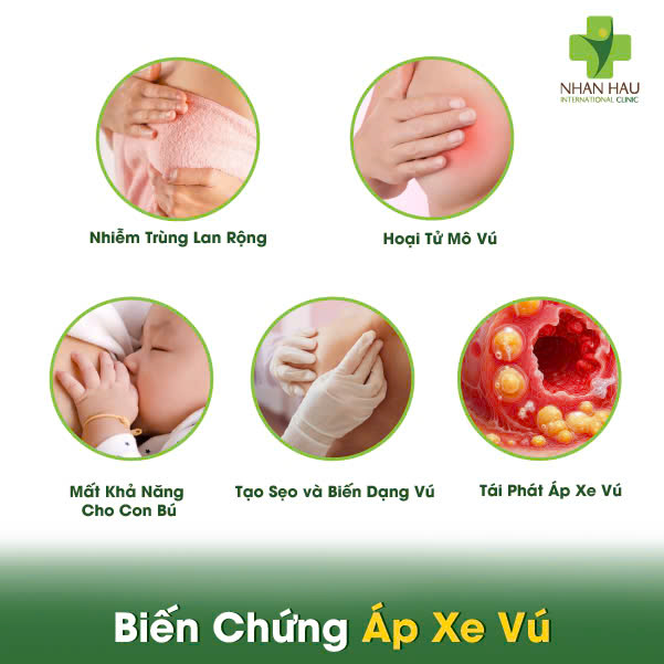 Biến Chứng Áp Xe Vú