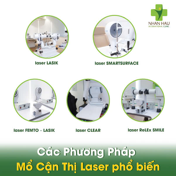 Các Phương Pháp Phổ Biến Mổ Cận Thị Laser phổ biến